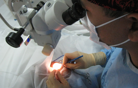 Microcirugía ocular